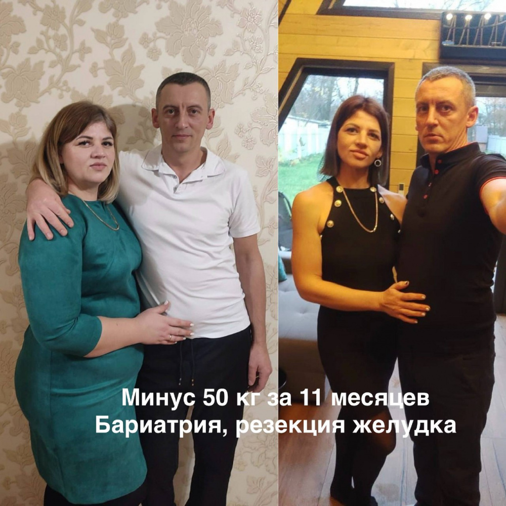 Что изменится после операции?
