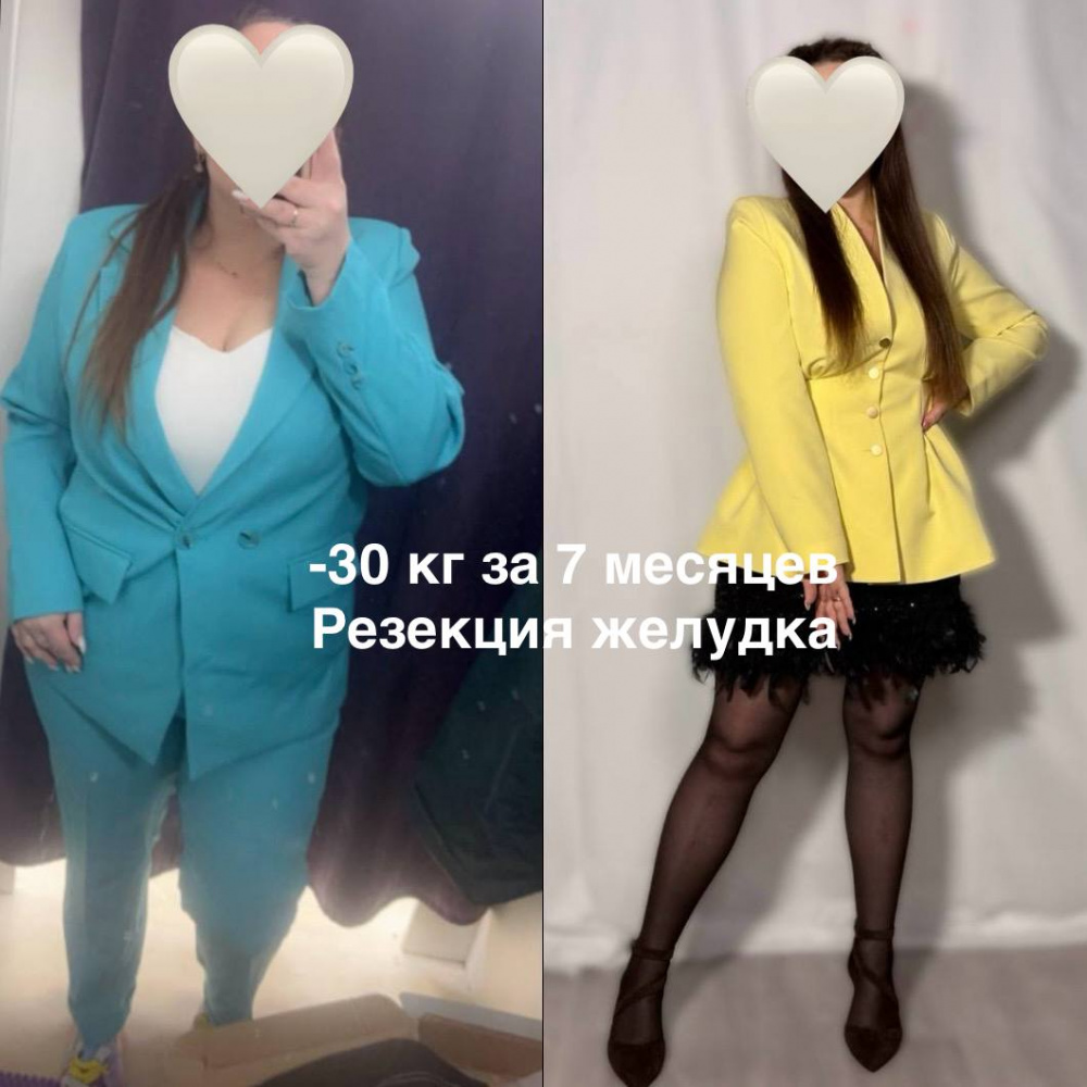 Что изменится после операции?