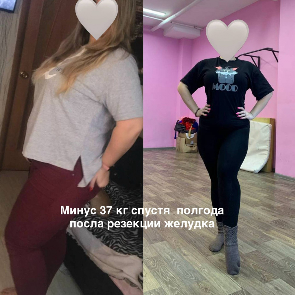 Что изменится после операции?